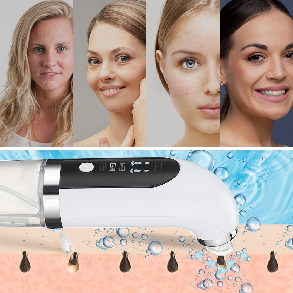 Electric Small Bubble Blackhead Remover USB Rechargeable Water Cycle