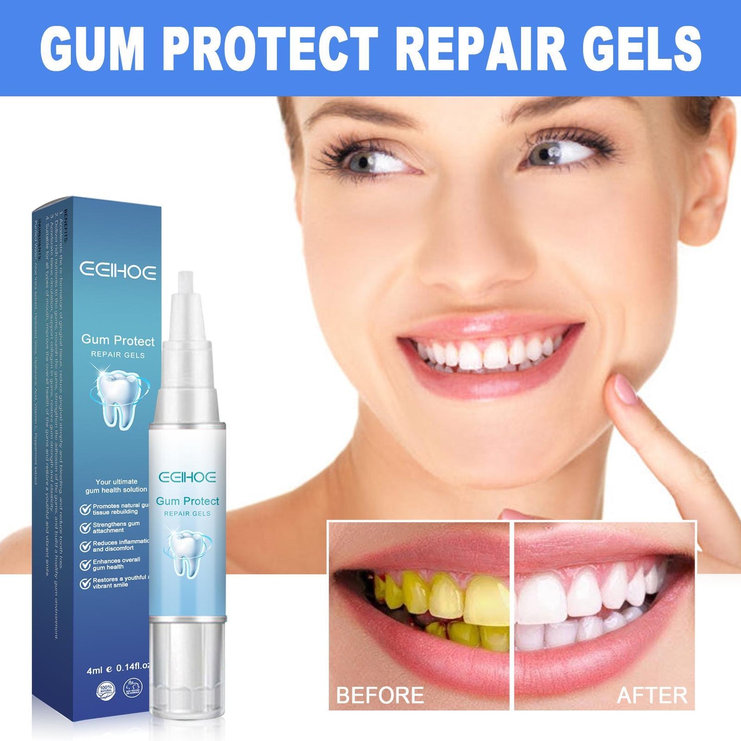 Yierhao Tooth Repair Gel, Repair Gums, Clean Teeth Stains, Tartar, Oral Care